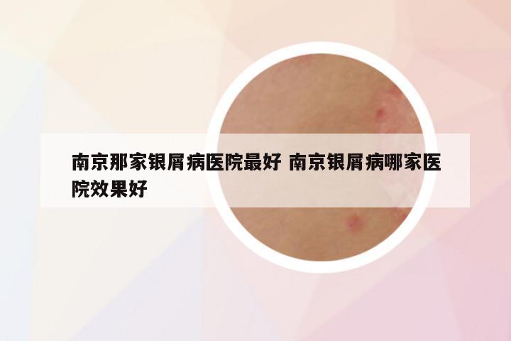 南京那家银屑病医院最好 南京银屑病哪家医院效果好