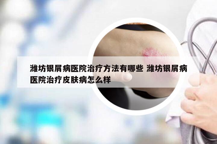 潍坊银屑病医院治疗方法有哪些 潍坊银屑病医院治疗皮肤病怎么样