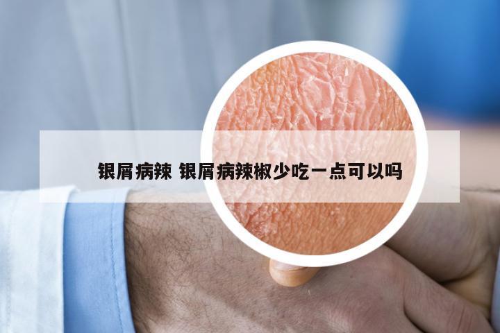 银屑病辣 银屑病辣椒少吃一点可以吗