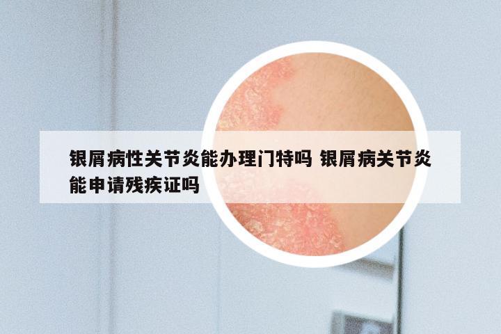 银屑病性关节炎能办理门特吗 银屑病关节炎能申请残疾证吗