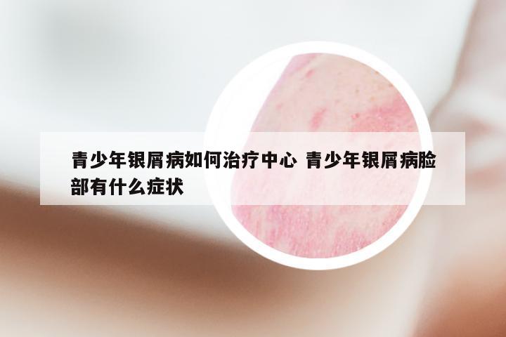 青少年银屑病如何治疗中心 青少年银屑病脸部有什么症状