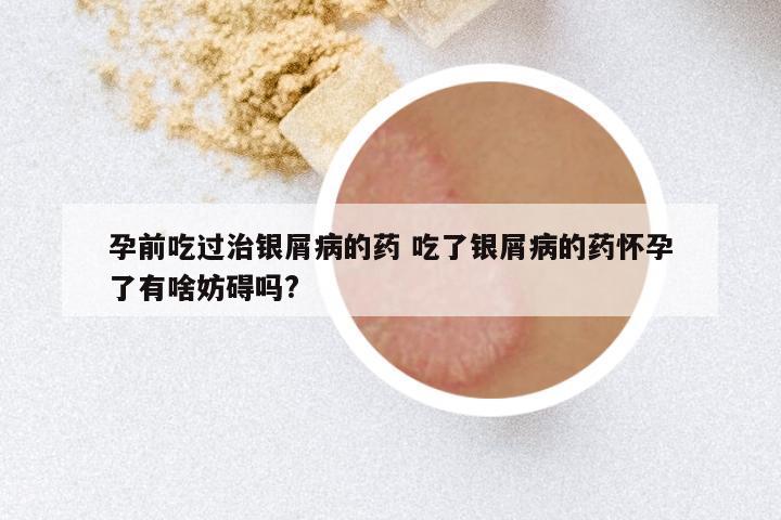 孕前吃过治银屑病的药 吃了银屑病的药怀孕了有啥妨碍吗?