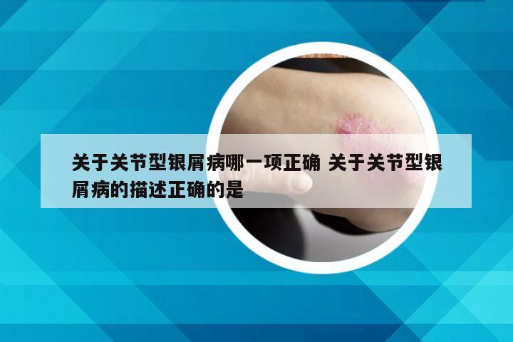 关于关节型银屑病哪一项正确 关于关节型银屑病的描述正确的是