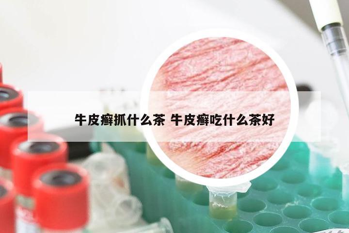 牛皮癣抓什么茶 牛皮癣吃什么茶好