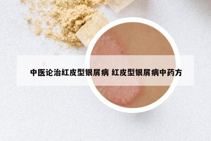 中医论治红皮型银屑病 红皮型银屑病中药方