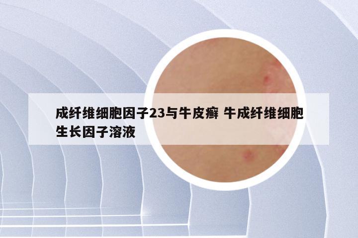 成纤维细胞因子23与牛皮癣 牛成纤维细胞生长因子溶液