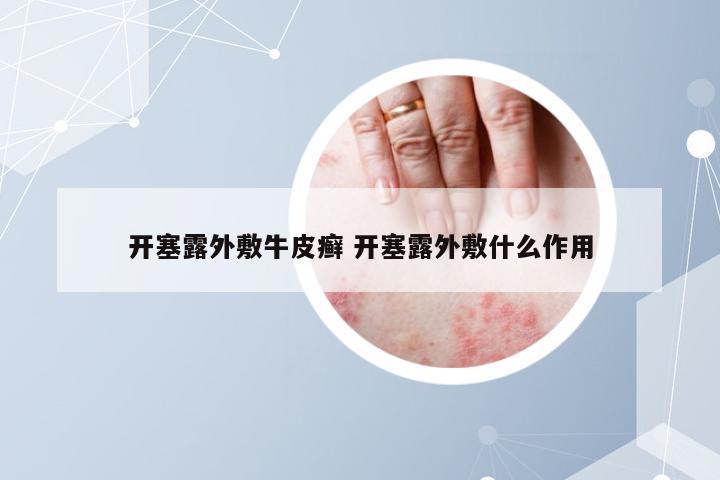 开塞露外敷牛皮癣 开塞露外敷什么作用