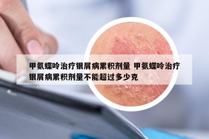 甲氨蝶呤治疗银屑病累积剂量 甲氨蝶呤治疗银屑病累积剂量不能超过多少克