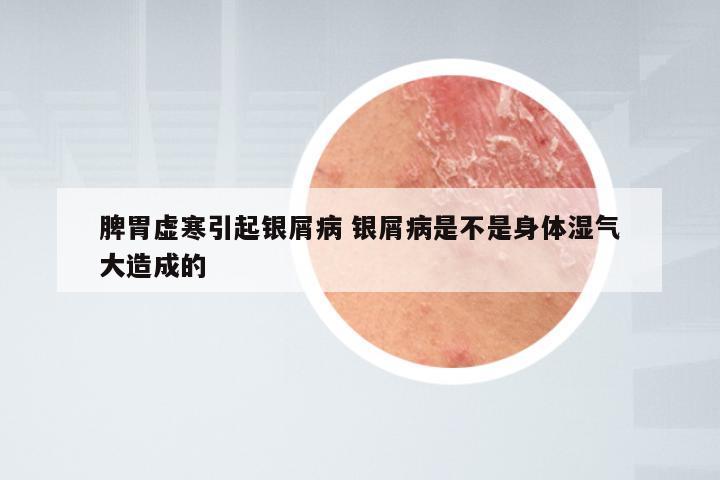 脾胃虚寒引起银屑病 银屑病是不是身体湿气大造成的
