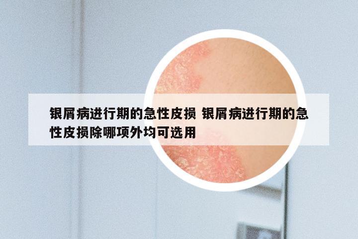银屑病进行期的急性皮损 银屑病进行期的急性皮损除哪项外均可选用