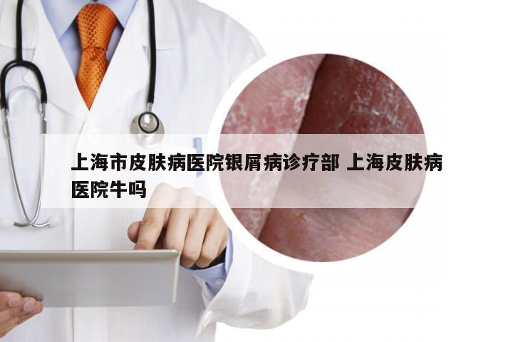上海市皮肤病医院银屑病诊疗部 上海皮肤病医院牛吗
