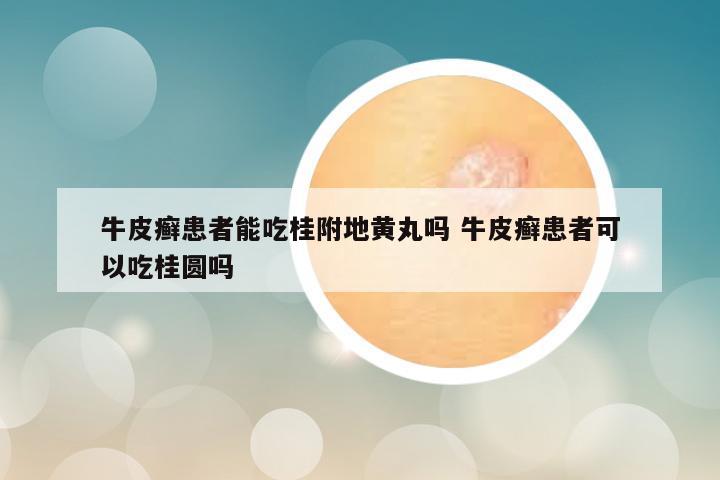 牛皮癣患者能吃桂附地黄丸吗 牛皮癣患者可以吃桂圆吗