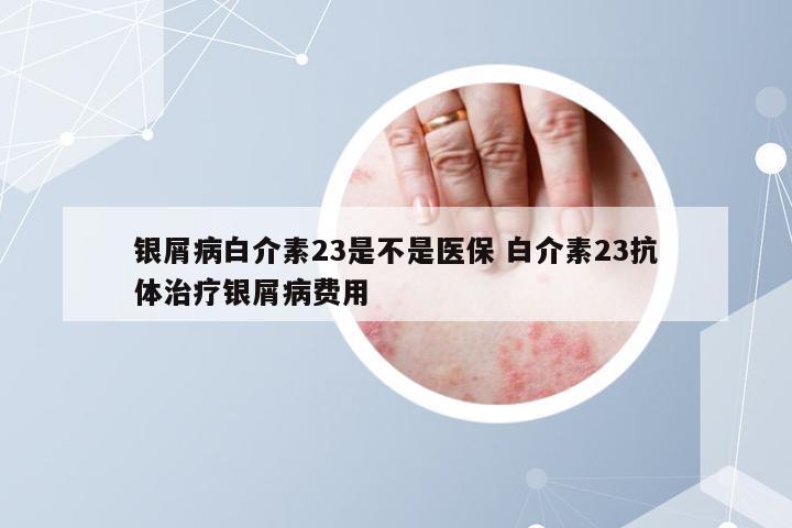 银屑病白介素23是不是医保 白介素23抗体治疗银屑病费用