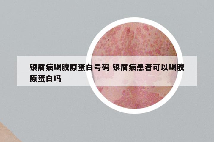银屑病喝胶原蛋白号码 银屑病患者可以喝胶原蛋白吗