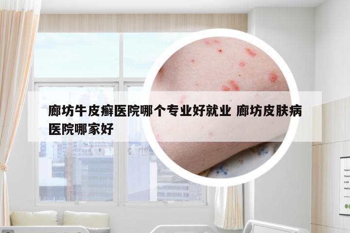廊坊牛皮癣医院哪个专业好就业 廊坊皮肤病医院哪家好