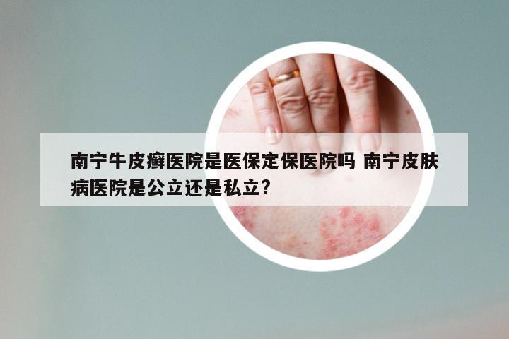 南宁牛皮癣医院是医保定保医院吗 南宁皮肤病医院是公立还是私立?