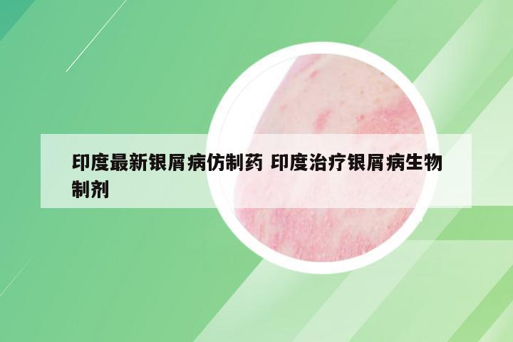 印度最新银屑病仿制药 印度治疗银屑病生物制剂