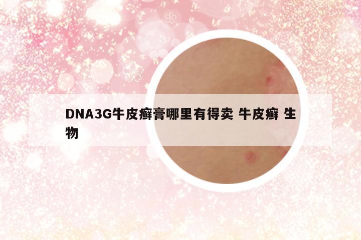 DNA3G牛皮癣膏哪里有得卖 牛皮癣 生物