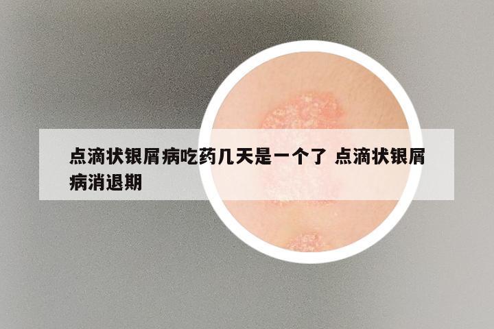 点滴状银屑病吃药几天是一个了 点滴状银屑病消退期