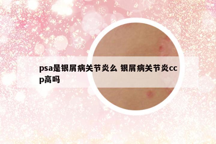 psa是银屑病关节炎么 银屑病关节炎ccp高吗