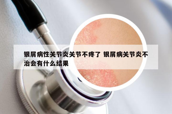 银屑病性关节炎关节不疼了 银屑病关节炎不治会有什么结果