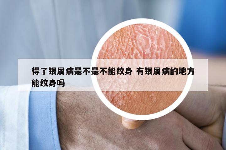 得了银屑病是不是不能纹身 有银屑病的地方能纹身吗
