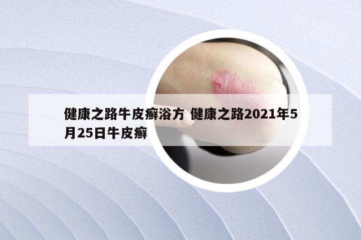 健康之路牛皮癣浴方 健康之路2021年5月25日牛皮癣