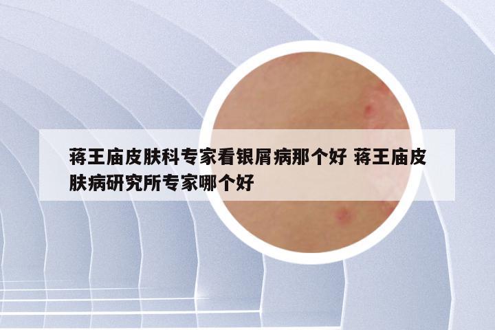 蒋王庙皮肤科专家看银屑病那个好 蒋王庙皮肤病研究所专家哪个好