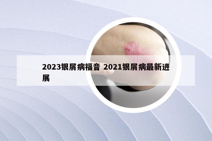 2023银屑病福音 2021银屑病最新进展