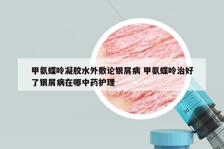 甲氨蝶呤凝胶水外敷论银屑病 甲氨蝶呤治好了银屑病在哪中药护理