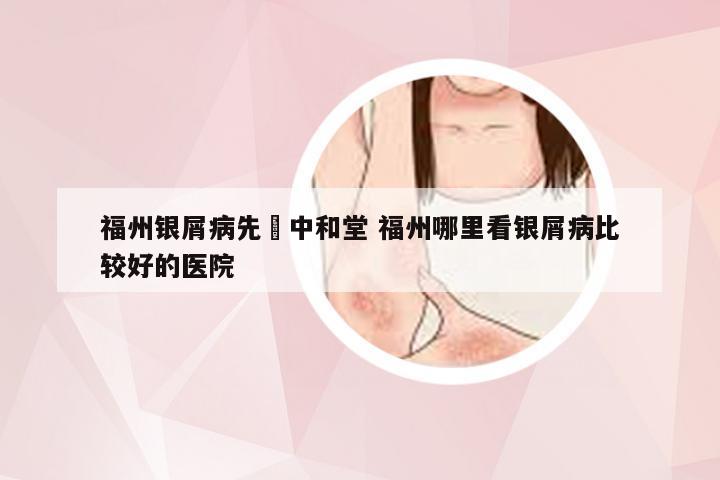 福州银屑病先來中和堂 福州哪里看银屑病比较好的医院