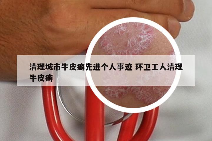清理城市牛皮癣先进个人事迹 环卫工人清理牛皮癣