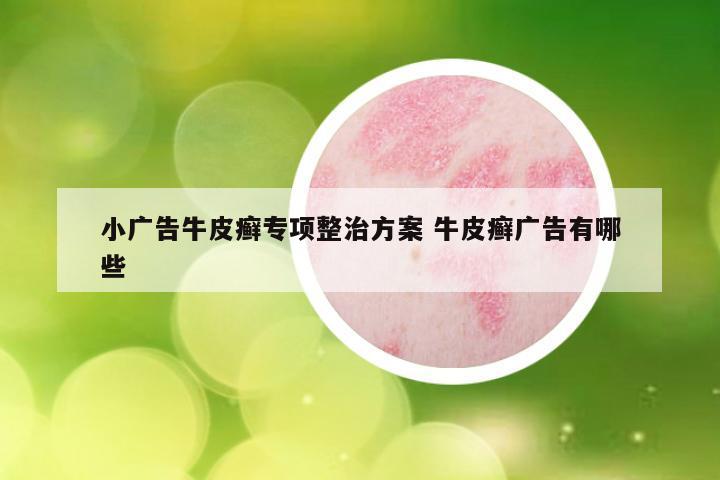 小广告牛皮癣专项整治方案 牛皮癣广告有哪些