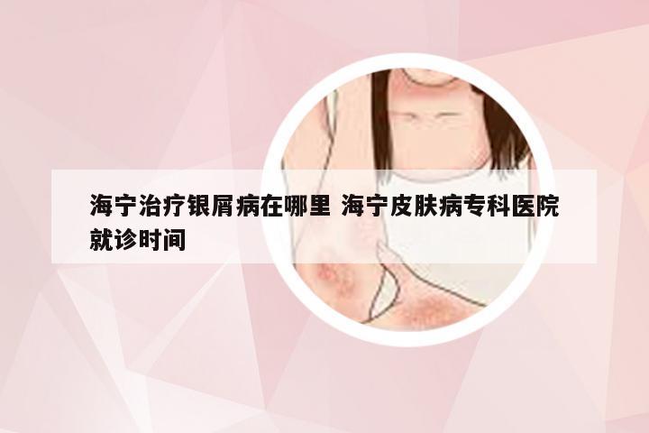 海宁治疗银屑病在哪里 海宁皮肤病专科医院就诊时间