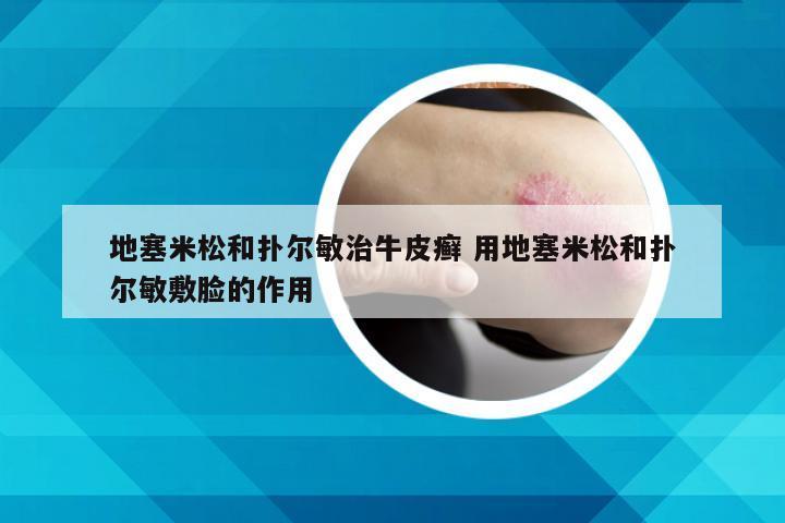 地塞米松和扑尔敏治牛皮癣 用地塞米松和扑尔敏敷脸的作用