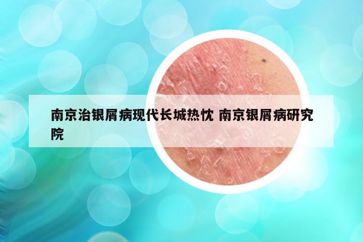 南京治银屑病现代长城热忱 南京银屑病研究院