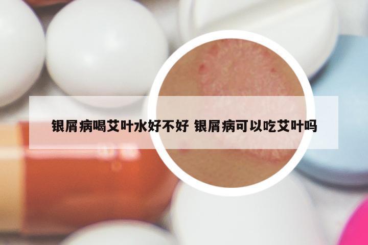 银屑病喝艾叶水好不好 银屑病可以吃艾叶吗