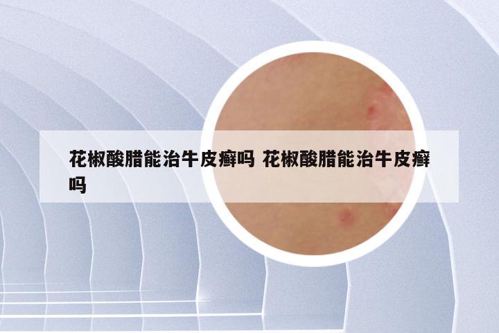 花椒酸腊能治牛皮癣吗 花椒酸腊能治牛皮癣吗