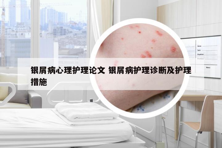 银屑病心理护理论文 银屑病护理诊断及护理措施