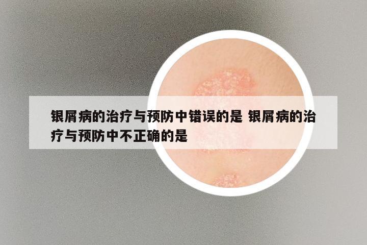 银屑病的治疗与预防中错误的是 银屑病的治疗与预防中不正确的是