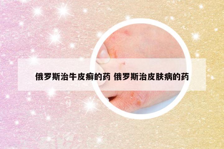 俄罗斯治牛皮癣的药 俄罗斯治皮肤病的药