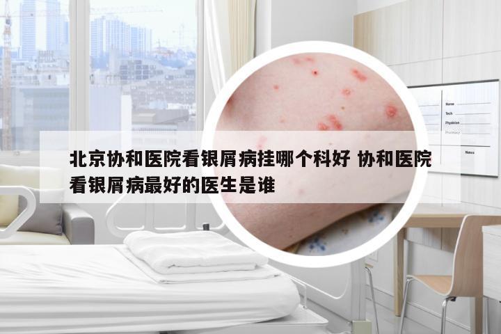 北京协和医院看银屑病挂哪个科好 协和医院看银屑病最好的医生是谁