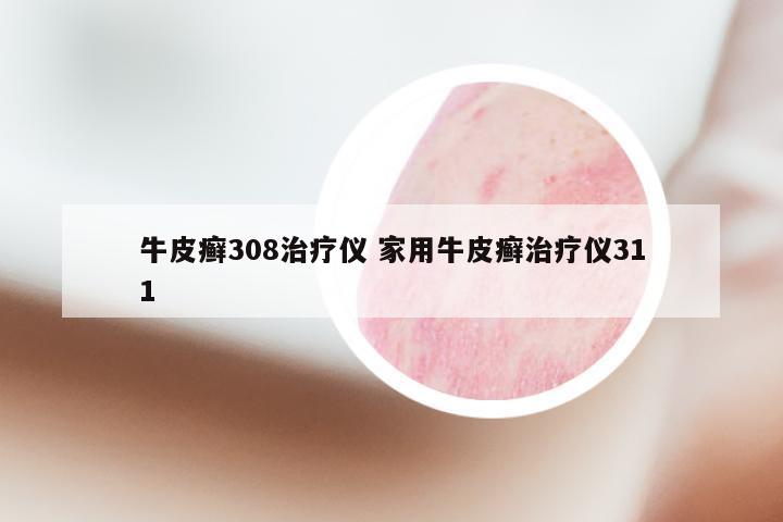 牛皮癣308治疗仪 家用牛皮癣治疗仪311