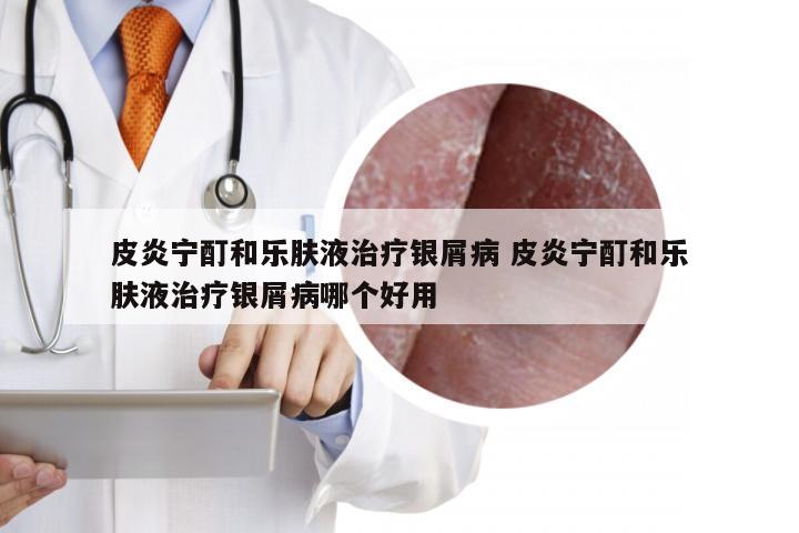 皮炎宁酊和乐肤液治疗银屑病 皮炎宁酊和乐肤液治疗银屑病哪个好用