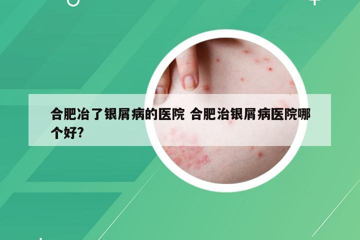 合肥冶了银屑病的医院 合肥治银屑病医院哪个好?