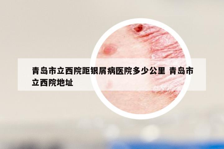 青岛市立西院距银屑病医院多少公里 青岛市立西院地址