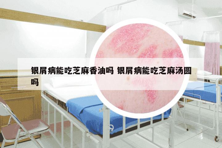 银屑病能吃芝麻香油吗 银屑病能吃芝麻汤圆吗