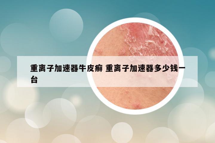 重离子加速器牛皮癣 重离子加速器多少钱一台