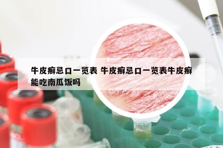牛皮癣忌口一览表 牛皮癣忌口一览表牛皮癣能吃南瓜饭吗