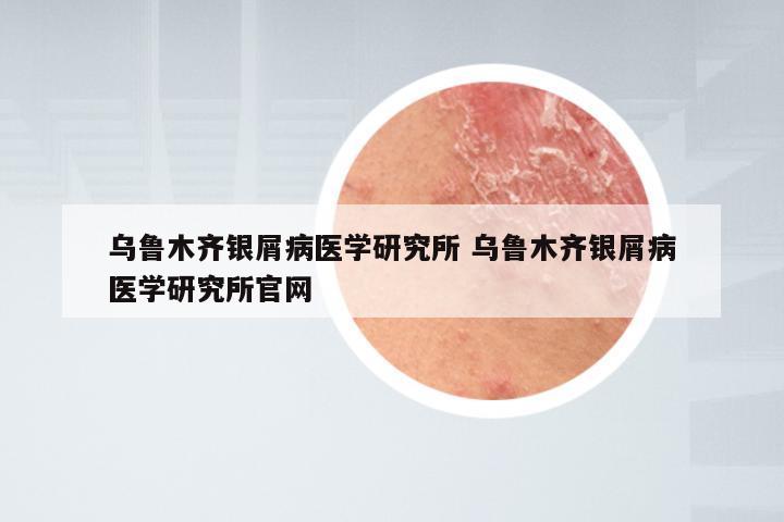 乌鲁木齐银屑病医学研究所 乌鲁木齐银屑病医学研究所官网